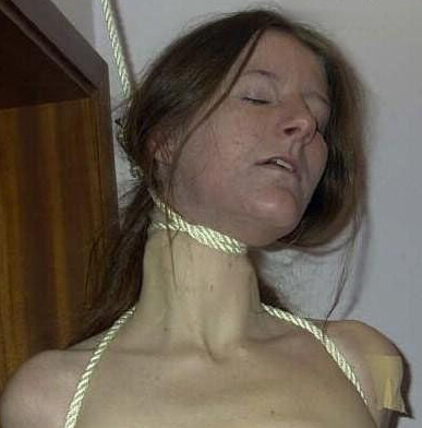 女性の首吊り自殺者の首に縄が食い込んでいる様子