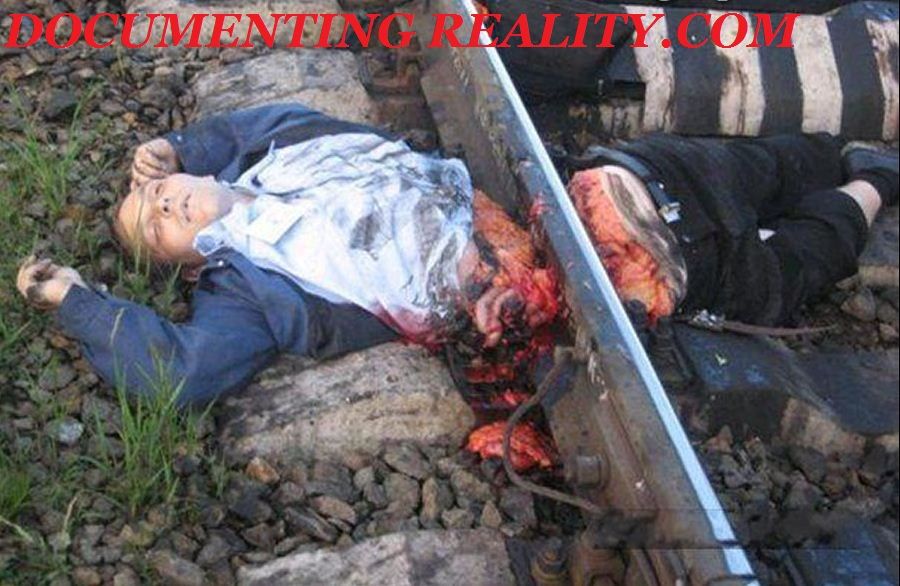 列車に轢断されて腰の位置で真っ二つになった投身自殺者の死体
