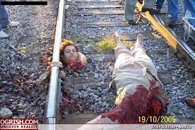 首がもげた鉄道自殺者の死体